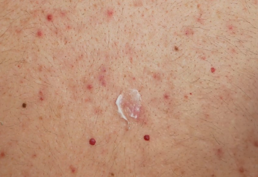 Close up of a cream applied on a skin